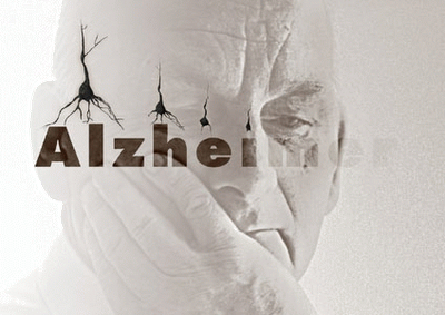 ‘Lo importante es la salud’ Prog. 13 ‘El organismo enfermo es un organismo acidificado’ y ‘El Alzheimer’